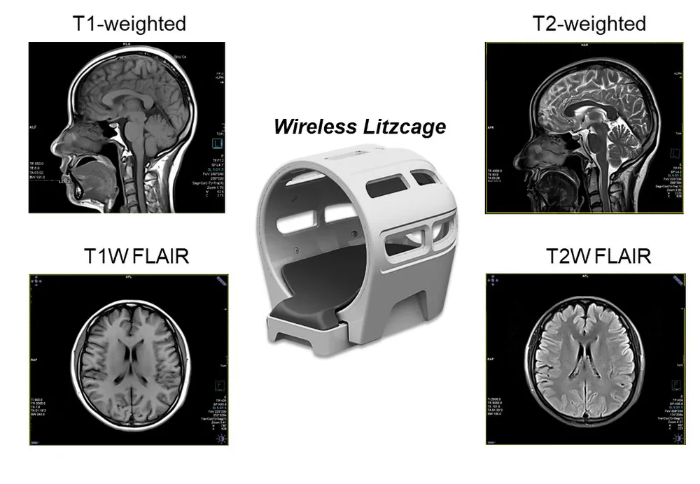 Wireless Litzcage Head Coil